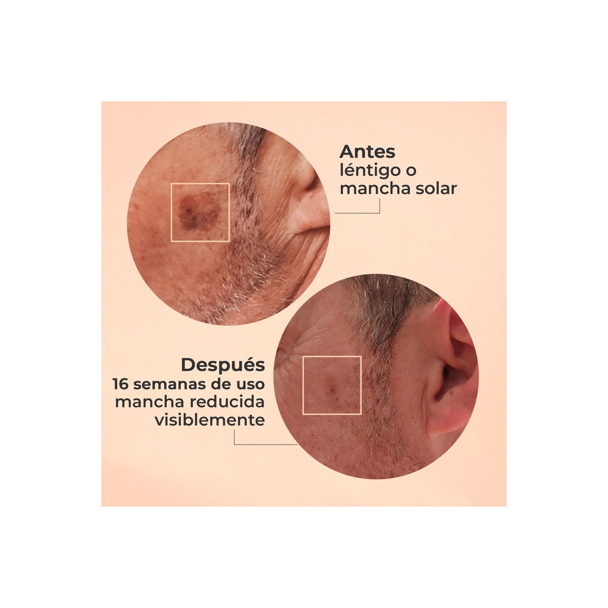 Segle Serum Glicolmix 30ml