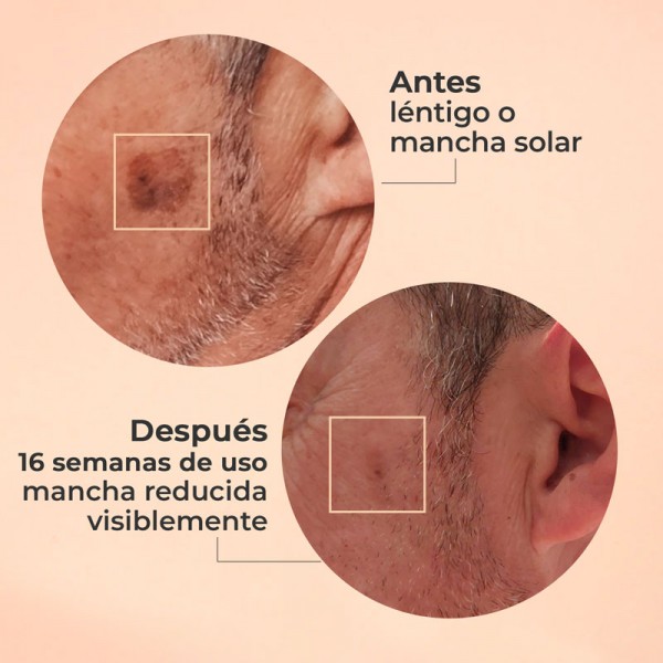 Segle Serum Glicolmix 30ml